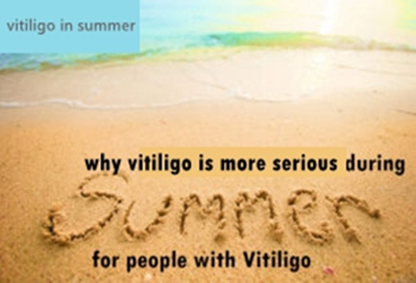 vitiligo in summer.jpg