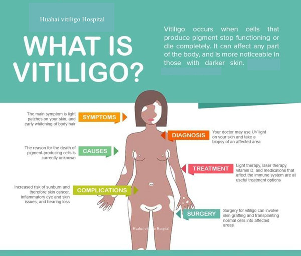 what is vitiligo.jpg