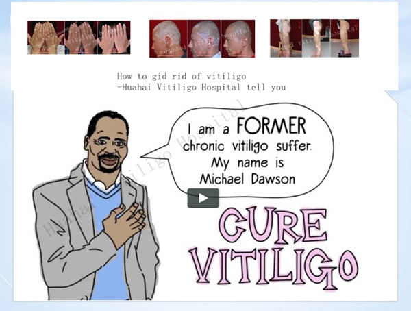 vitiligo cure.jpg